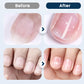 Nährendes Nagelreparaturspray