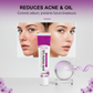 20 ml Aknecreme mit 12 % Azelainsäure